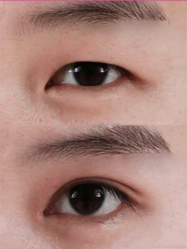 眼球的大小是从出生到衰老唯一不会变大或变小的部位,_圈子-新氧美容