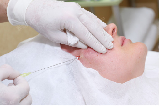 揭秘大v线提升有副作用吗?大v线提升后颧骨变大了咋办?求解?