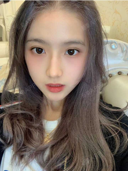 隆鼻子手术风险大吗,隆鼻手术多久恢复自然对于现在很_圈子-新氧美容