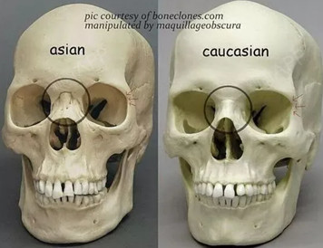 由于不同人种颅骨构造的差异,欧美人更容易发育出饱满的眉心三角,增加