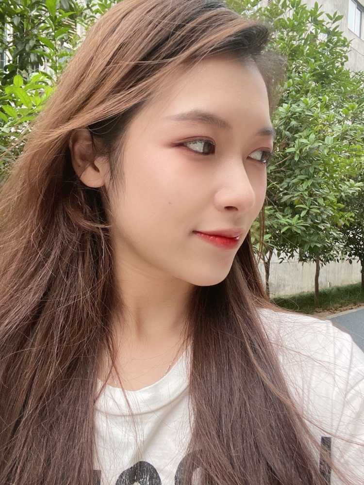 【沈阳美莱—韩式生科假体隆鼻术后150天】眼瞅着在_圈子-新氧美容