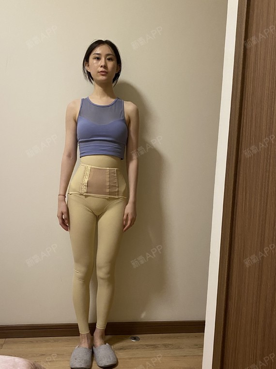 大腿环吸反馈来喽