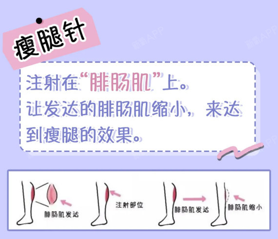 2瘦腿针的特点 ①安全:瘦腿效果显著.