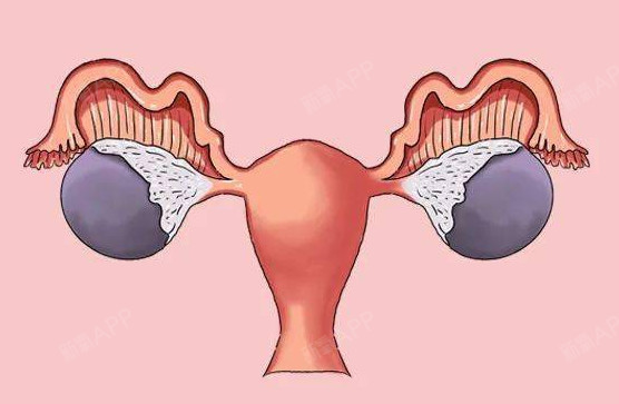 女性雌激素低的症状雌性激素低会怎么样