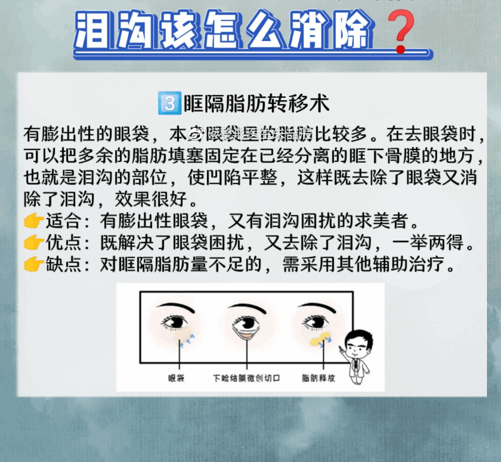 泪沟型眼袋形成的原因图片