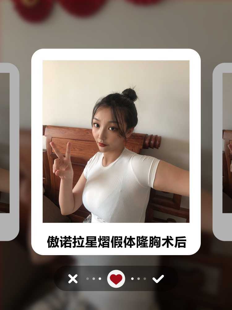 【傲诺拉星熠假体隆胸手术】最近身边有些宝宝总是来问_圈子-新氧美容