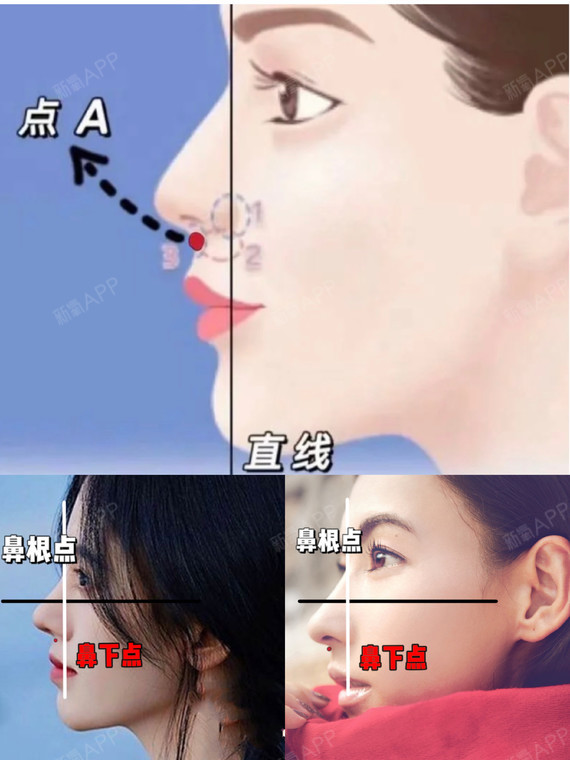 自测丨你真的需要垫鼻基底吗71