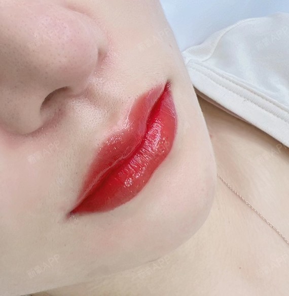 半永久纹唇yyds三个月前做了纹唇之前纹的嘴巴已经_圈子-新氧美容整形