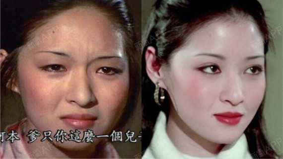 胡因梦单眼皮和双眼皮对比做了上眼皮去脂和双眼皮手术的胡因梦,美貌