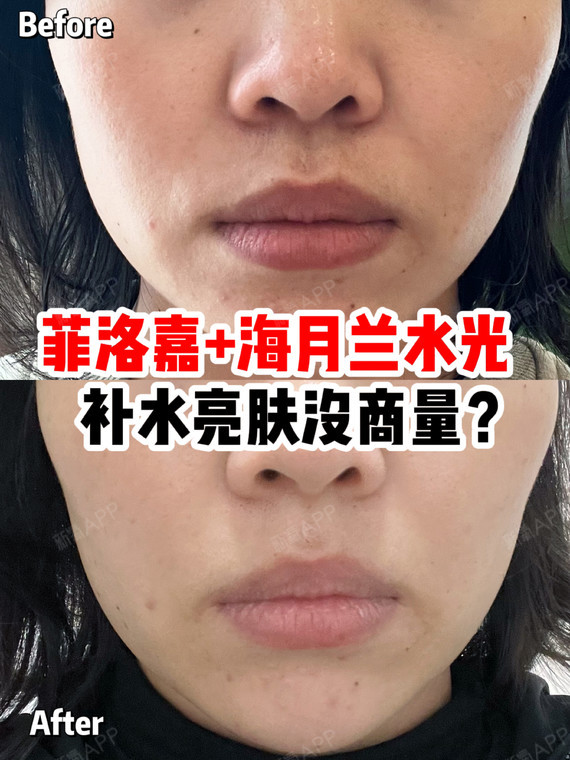 菲洛嘉海月兰水光评测丨补水亮肤全靠它71