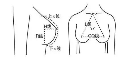 假体隆胸——你最关心的五个问题丨科普篇