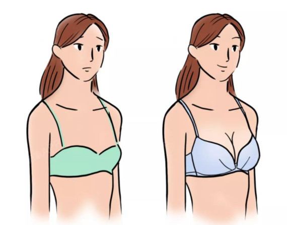 针灸能丰胸吗针灸丰胸有用吗