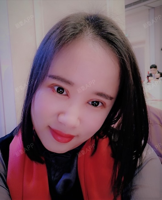 埋线双眼皮
