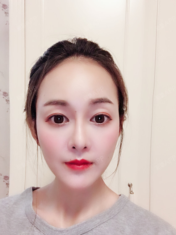 来看我迷人的小下巴