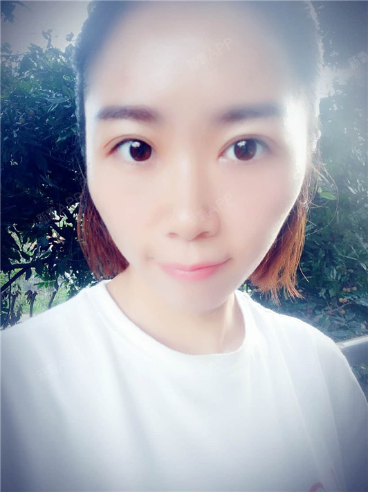 切开双眼皮