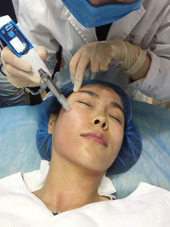 哈尔滨水光补水好不好_效果图_dffjj水光补水术后第0天_新氧美容整形