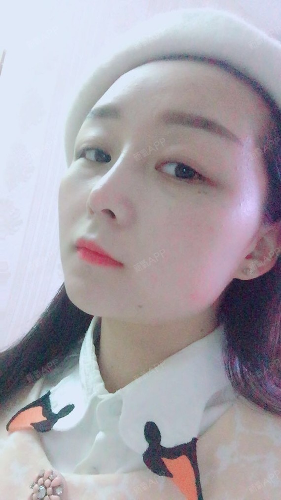 宝宝们,快来看看我的小琼鼻,就问宝宝们一句,好看不_圈子-新氧美容