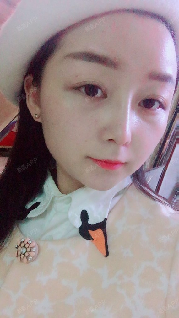 宝宝们,快来看看我的小琼鼻,就问宝宝们一句,好看不_圈子-新氧美容