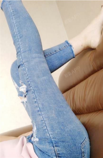已经很尽力拍了,现在大腿就是图中的样子,是细的,因_圈子-新氧美容