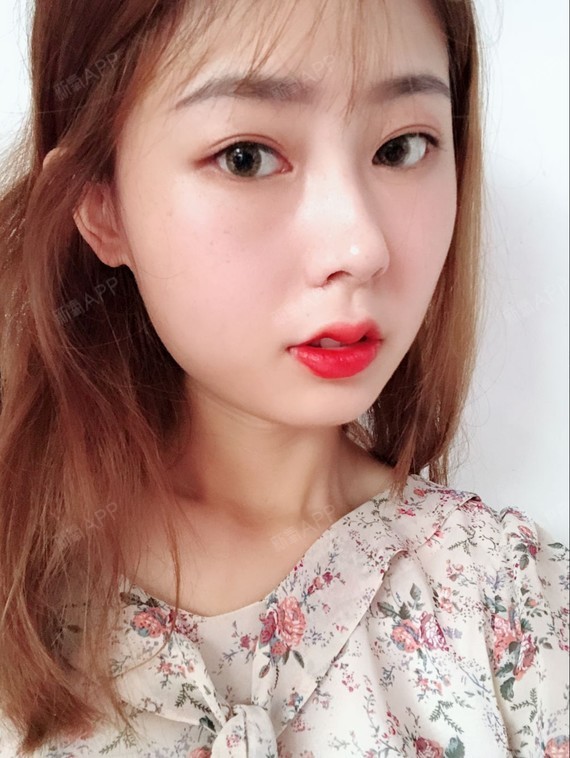 不仅打了嘟嘟唇还打了下巴.哼  心机girl  等吸收的差不多