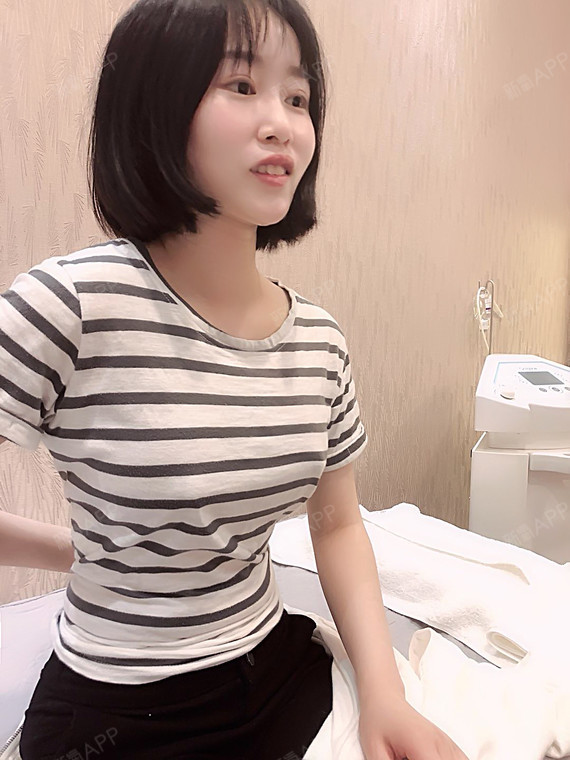 自体脂肪隆胸好不好_效果图_西瓜葡萄自体脂肪隆胸术后第129天_新氧