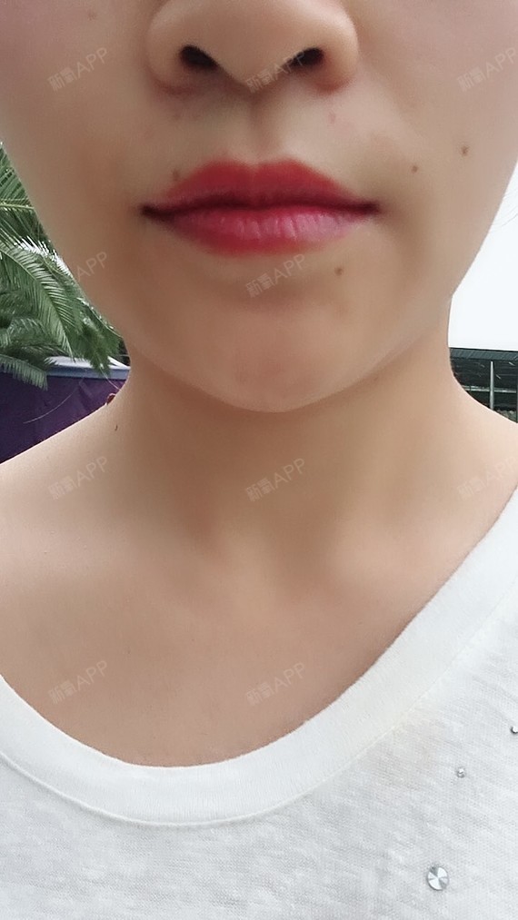半永久纹唇好不好_效果图_小小潇半永久纹唇术后第7天_新氧美容整形