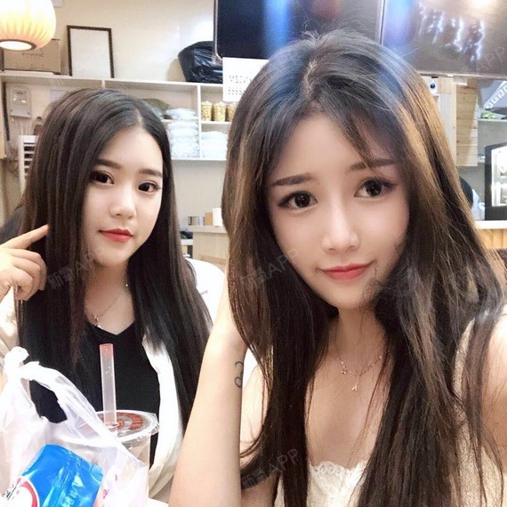 术后恢复这么长的时间,对我来说收获简直太多了,无论_圈子-新氧美容