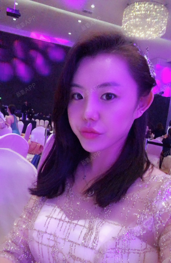 畸形耳朵手术后会痛苦多久呢_畸形耳朵手术医院_一只耳朵畸形手术