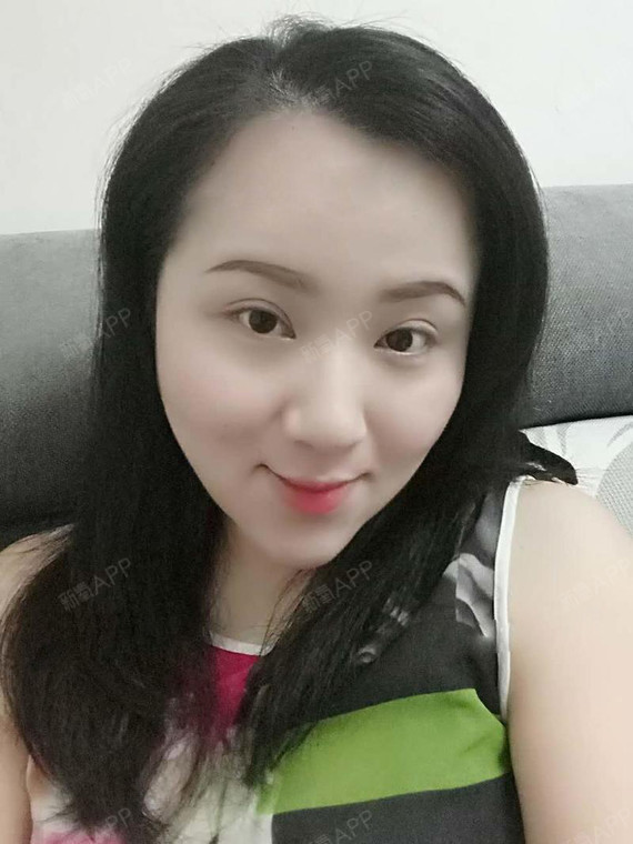 新氧- 邢傲风云 | 面部轮廓 | 术后当自强 | 埋线提升 | 北京同城