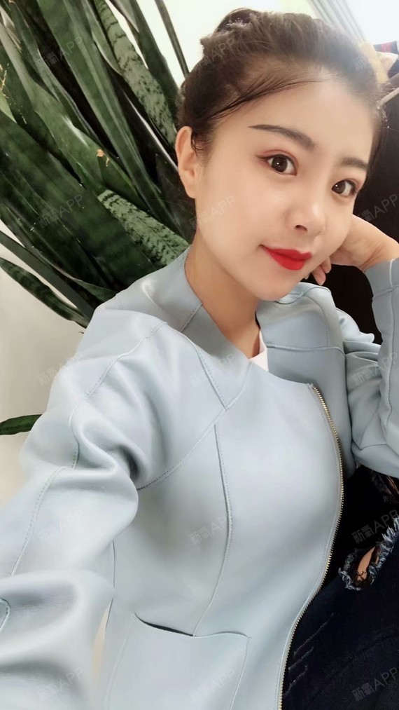 北京手术紧缩阴道好不好_效果图_凝芙1手术紧缩阴道术后第1天_新氧