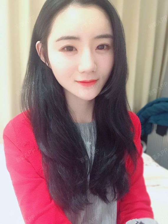 有人问我我双眼皮是不是做的~不是的哟,只有开眼