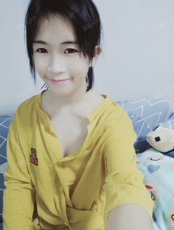 广州壹加壹隆胸术后第46天,现在胸变得越来越柔软了_圈子-新氧美容