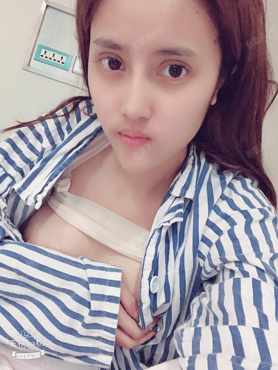 新氧- bu926268 | 胸部 | 隆胸 | 假体隆胸 | 术后当自强 | 重庆同城