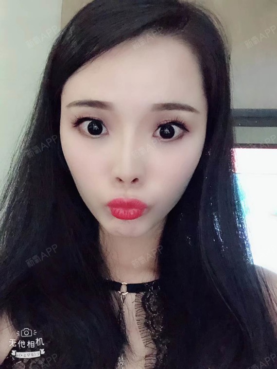 现在最期待的就是看到头顶的小毛毛_圈子-新氧美容整形