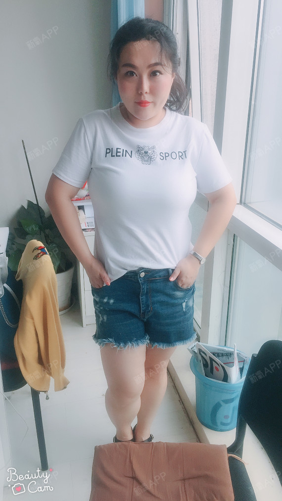 胖胖1吸脂瘦腰部第62天美丽日记