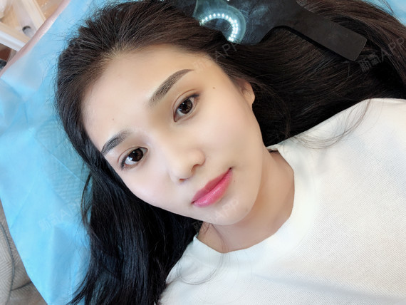 氧气0548半永久纹眉第1天美丽日记