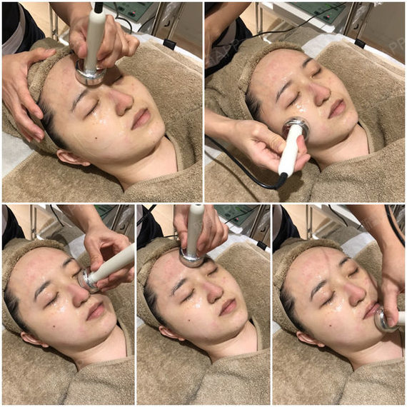 2018达姐姐玻尿酸导入第0天美丽日记