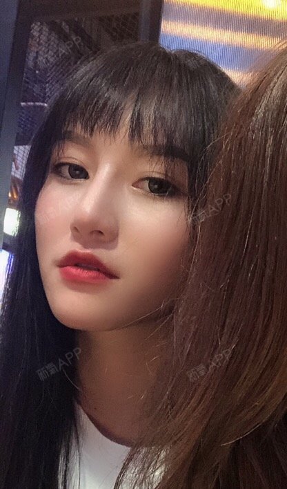 成都耳软骨复合隆鼻好不好_效果图_氧气r6nad9e耳软骨复合隆鼻术后第