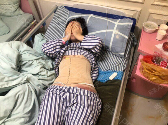 从小就相对比较胖,然后用过很多种方式去减肥,健身房