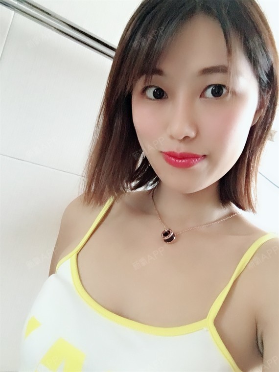 氧气tqh6d2a假体隆胸第79天美丽日记-新氧美容整形