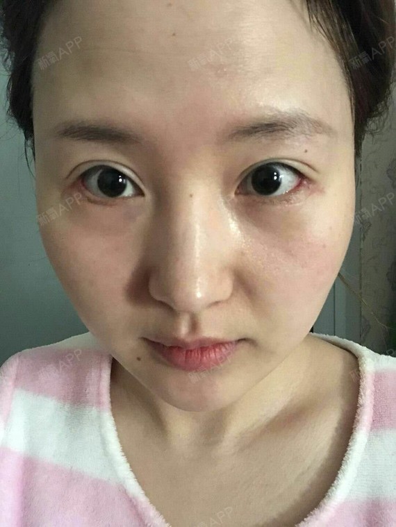 月色很美我很动人开外眼角第46天美丽日记