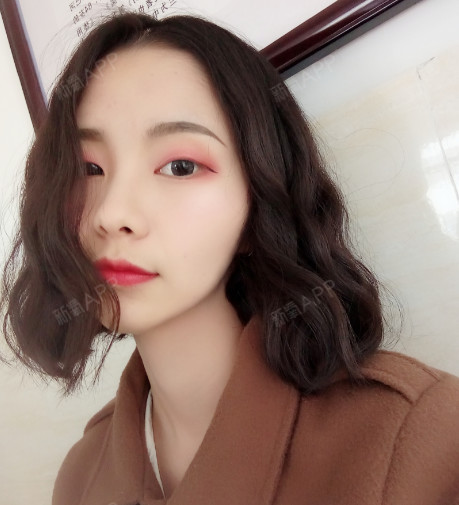 颧骨颧弓整形术