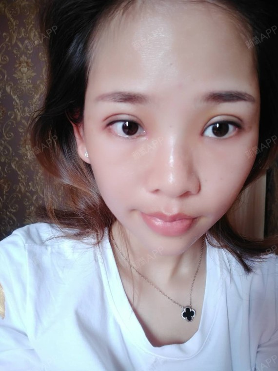 腾腾520眼部综合第10天美丽日记