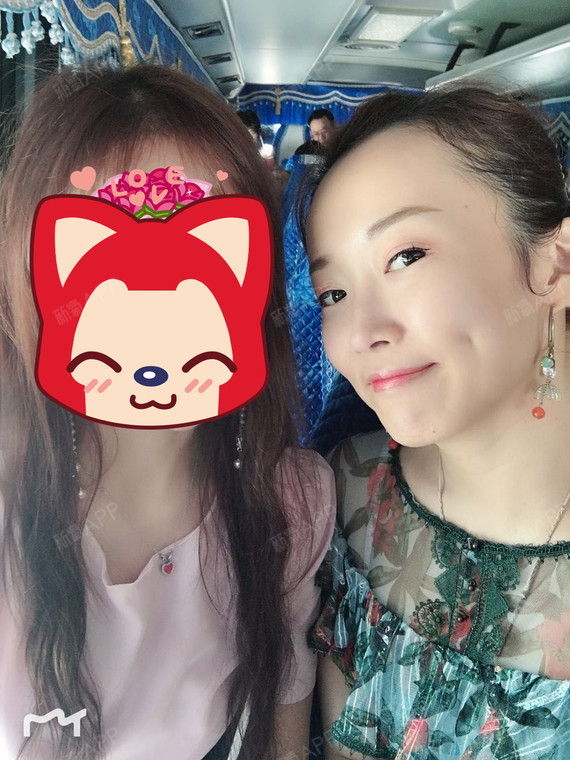 【埋线酒窝】一个月啦~好喜欢好喜欢,非常不后悔做这_圈子-新氧美容