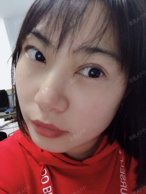 方不方耶眼部综合第10天美丽日记