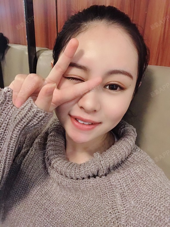 人家都说双眼皮要用一辈子的时间来恢复,哈哈哈哈我是有多幸运呢,让我