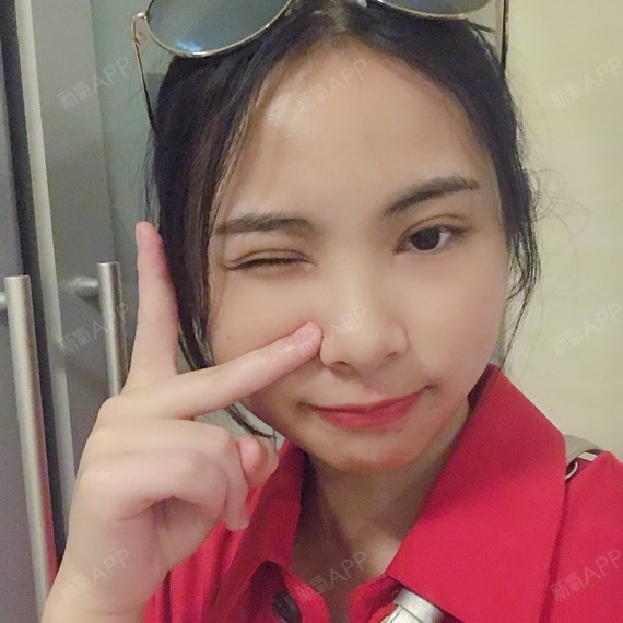 乖乖小仙女开内眼角第7天美丽日记