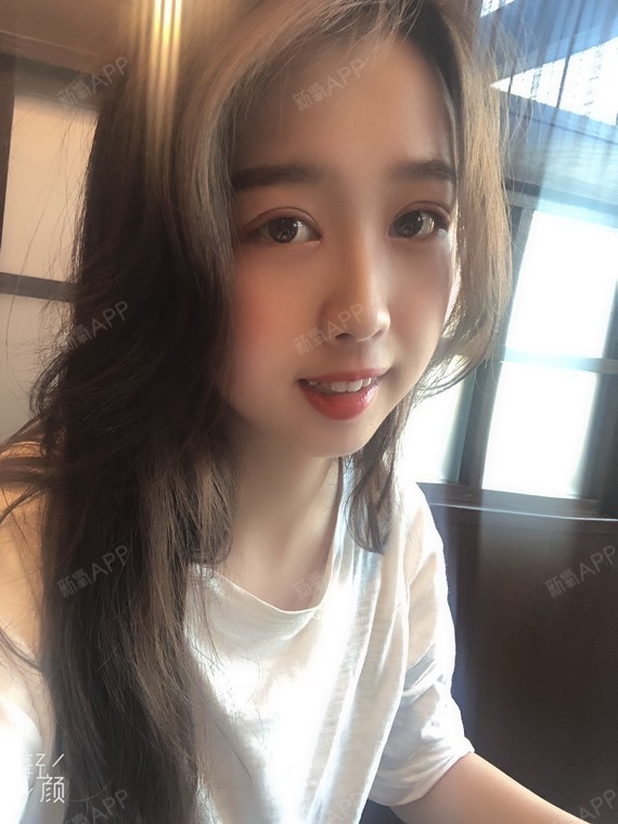 北京内切去眼袋好不好_效果图_氧气r60c38c内切去眼袋术后第50天_新氧