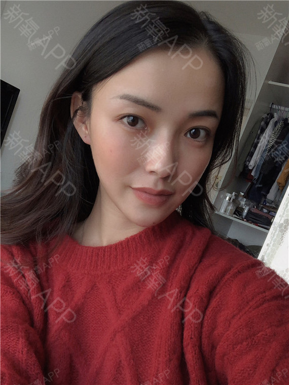 鼻子有点歪矫正_歪鼻子矫正有风险吗_歪鼻矫正后越来越歪了怎么办