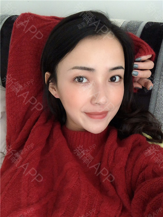 歪鼻矫正后越来越歪了怎么办_鼻子有点歪矫正_歪鼻子矫正有风险吗
